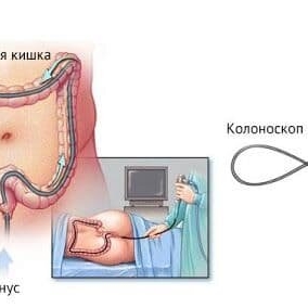Глубокое погружение в мир колоноскопии: всё, что нужно знать о диагностике и профилактике