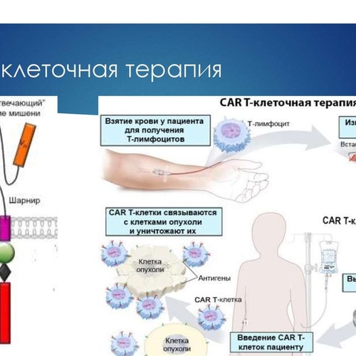 CAR-T терапия для лечения пациентов с лейкемией и лимфомой стала доступна в Турции
