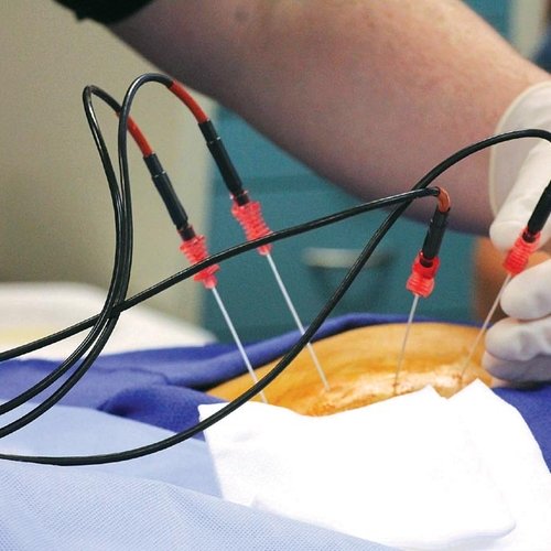 МедикаТур начала сотрудничество с доктором и профессором Немецкого центра термоабляции